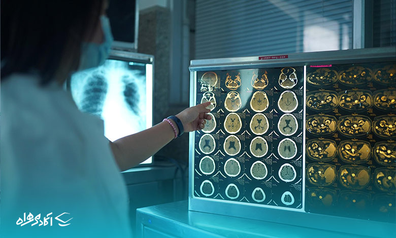 هوش مصنوعی و حوزه رادیولوژی